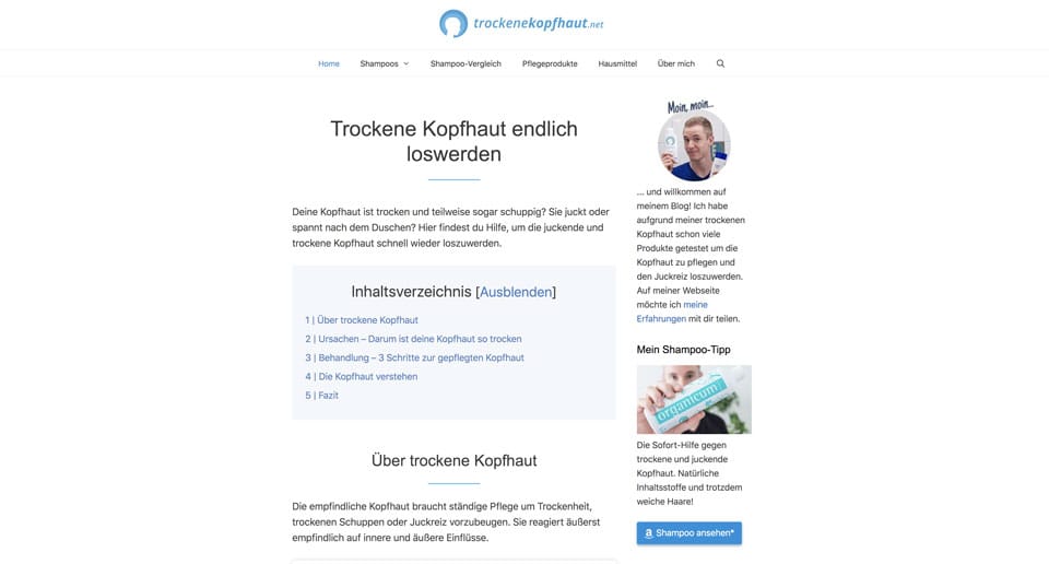 Nischenwebsite Beispiele trockenekopfhaut